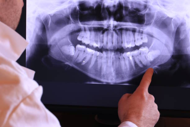 Best Dental Abscess Treatment in Stanley, ND